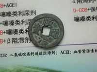 顺治通宝多大算大样
